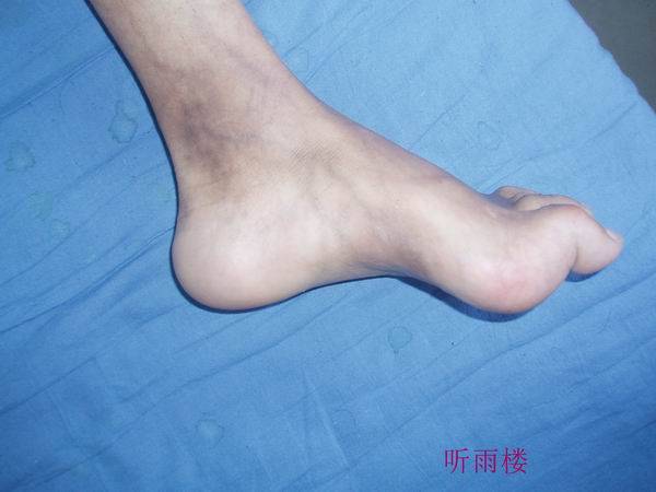 PB160160.JPG