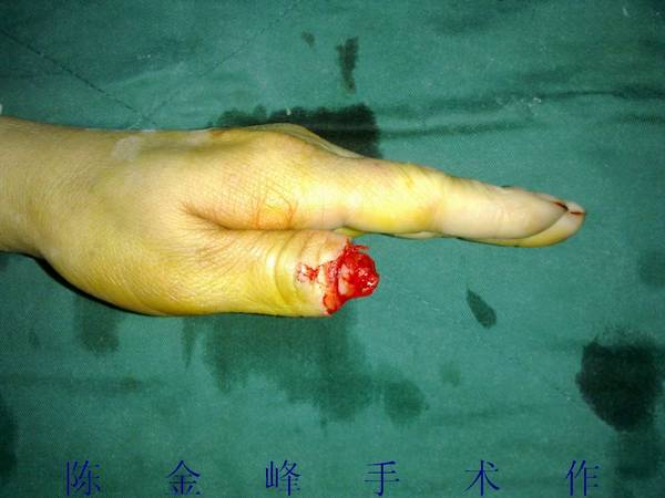 nEO_IMG_20111029550.jpg