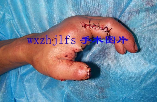100_1755.JPG