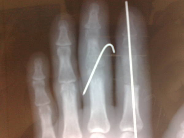201112061440.jpg