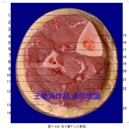 小腿下断层副本.jpg