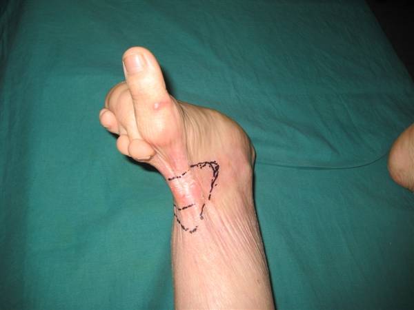 http_imgload6.jpg