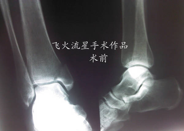 IMG_20111216_154531_副本.jpg