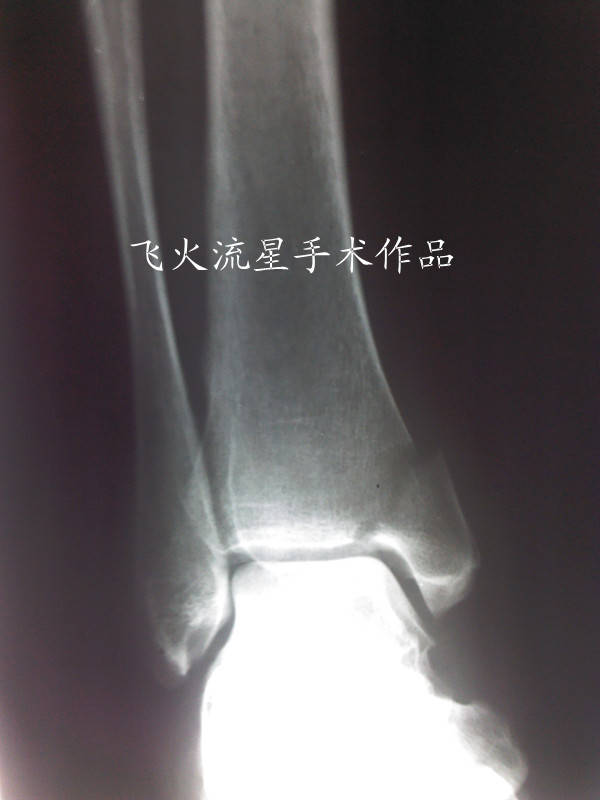 IMG_20111216_154552_副本.jpg