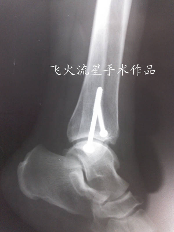 IMG_20111216_154717_副本.jpg