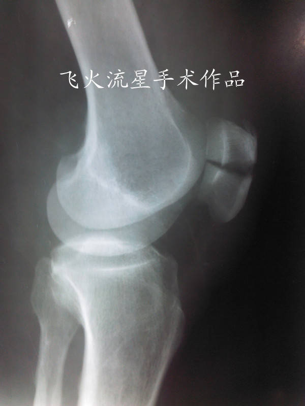 IMG_20111216_155124_副本.jpg