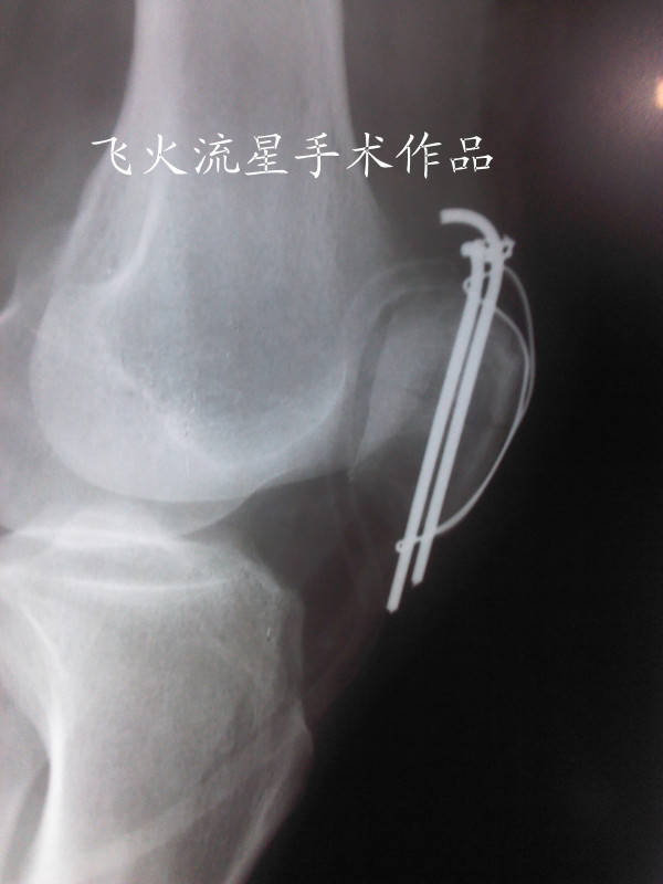 IMG_20111216_155136_副本.jpg