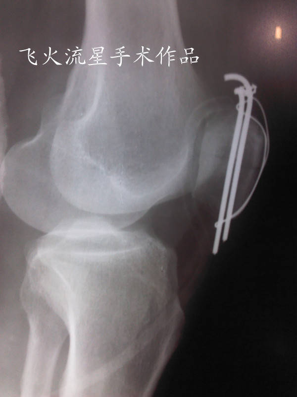 IMG_20111216_155206_副本.jpg