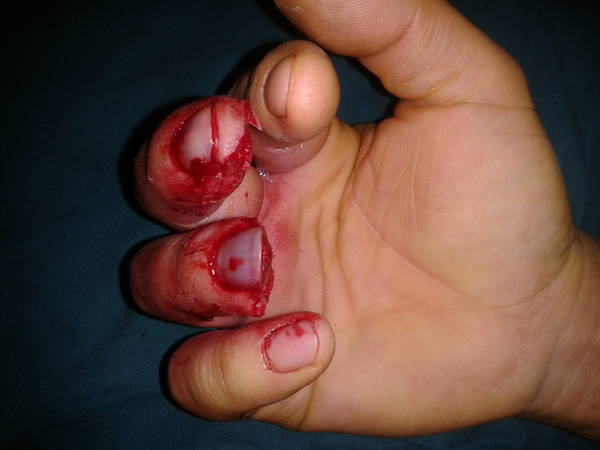 2011-12-02 10.36.31.jpg