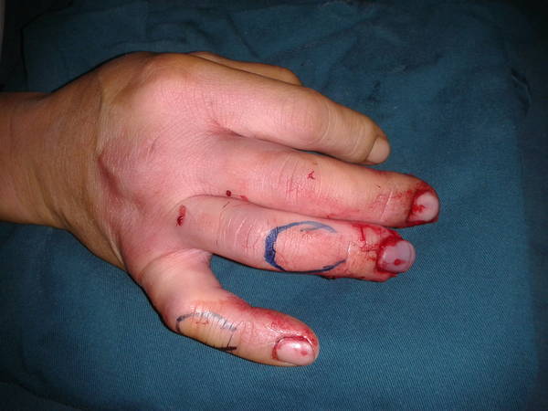 2011-12-02 10.37.56.jpg