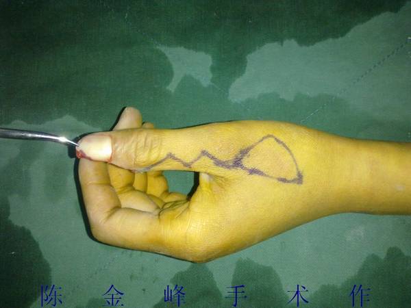nEO_IMG_20111125637.jpg