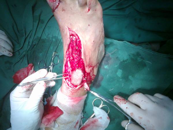 20111230126.jpg