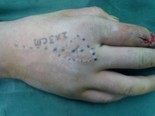 20110104171.jpg