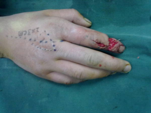 20110104172.jpg