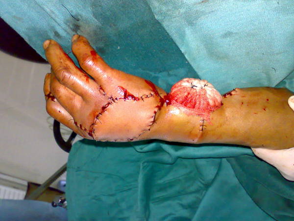 20111002544.jpg
