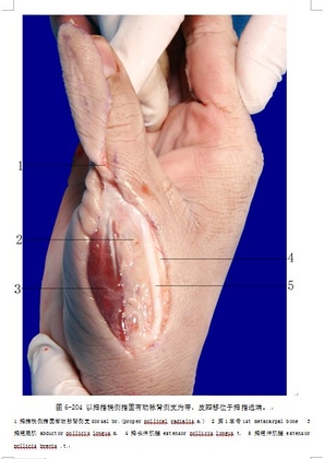 鱼际皮瓣解剖4.jpg