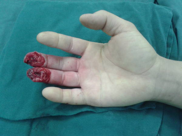 2011-12-02 10.36.42.jpg