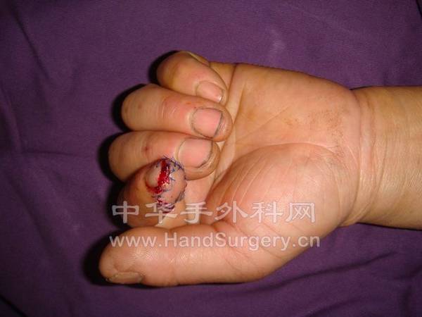 1002071215366c969990aed226_jpg_thumb.jpg