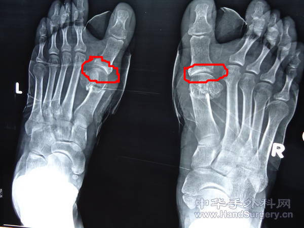 081154jtu9mowhioymvwju_jpg_thumb_副本.jpg