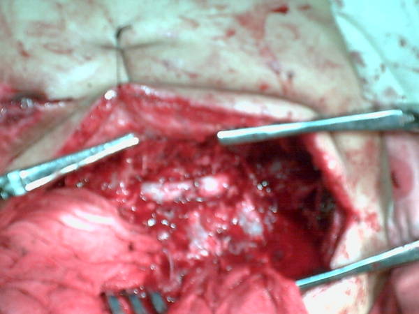 PICT0053.JPG