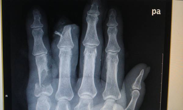 IMAG0156.jpg