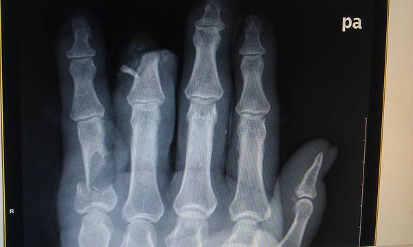 IMAG0157.jpg