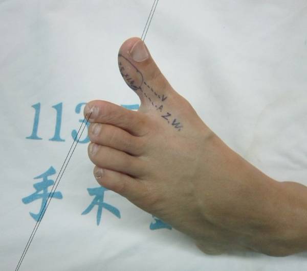 术中