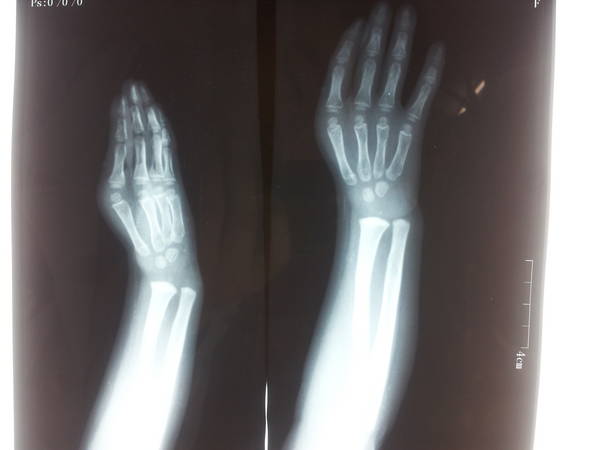 20120217_113611.jpg