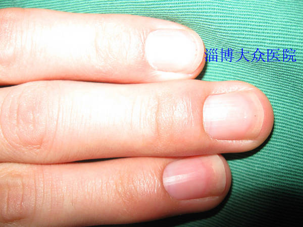 img_2155_副本_副本.jpg