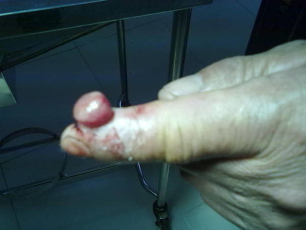 20120117316.jpg