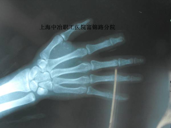 DSCF0199.jpg