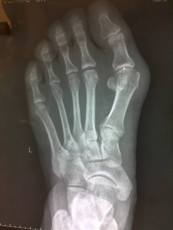 20120307168.jpg