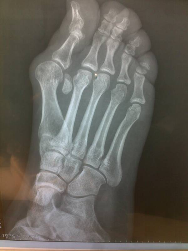 20120307169.jpg
