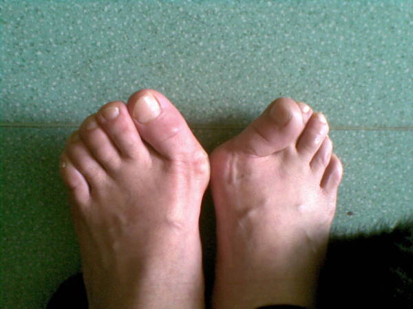 20120307.jpg