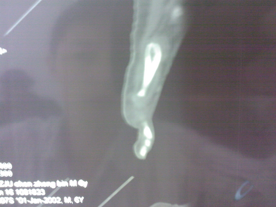 SPM_A0171.jpg