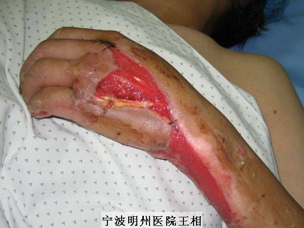 复件 IMG_4252.JPG