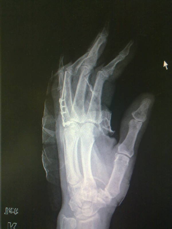 20111219269.jpg