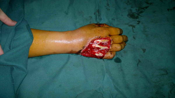 201203011054.jpg