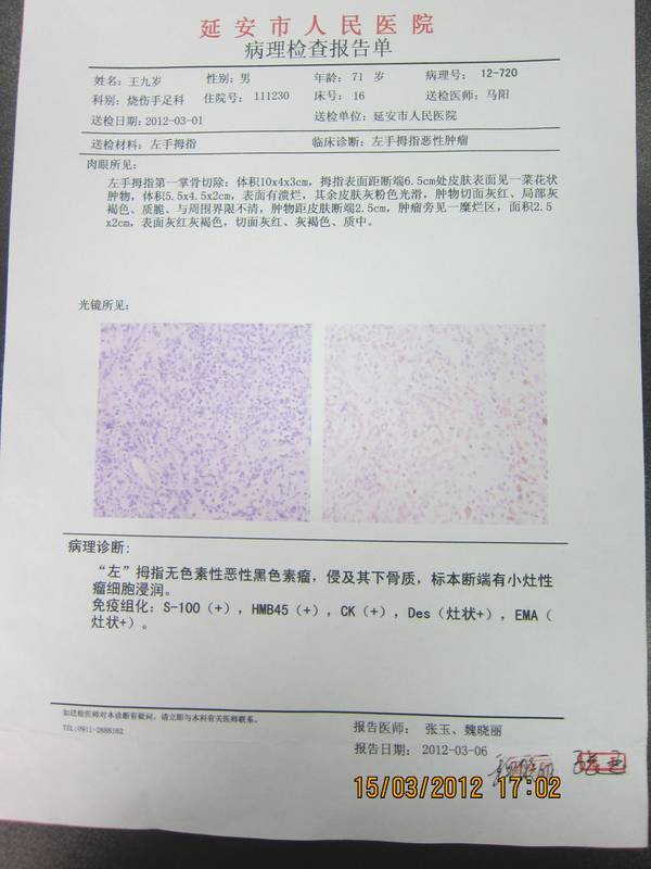病检报告