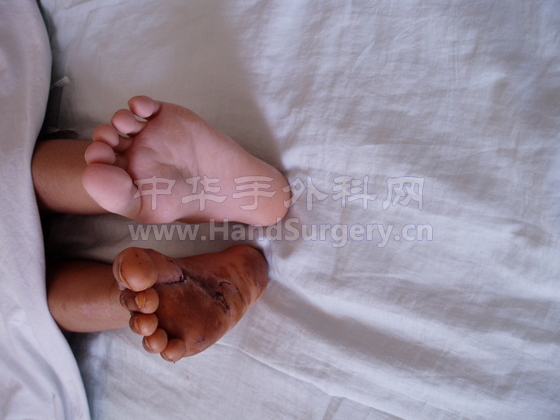 周丽术后6.JPG