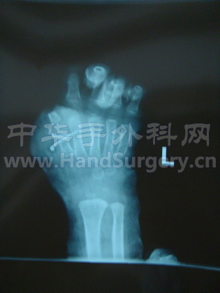 照片2.JPG