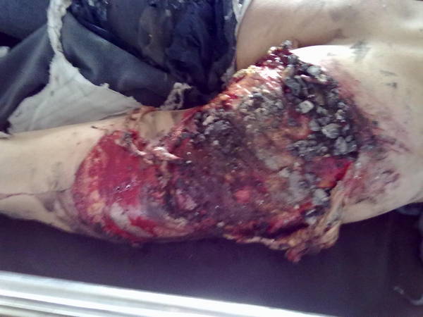 20120313350.jpg