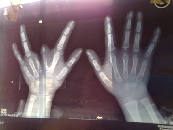 20120320355.jpg