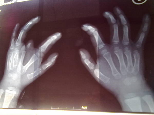 20120320356.jpg