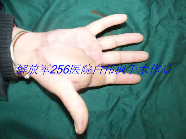 DSCF2835.JPG