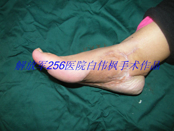 DSCF2842.JPG