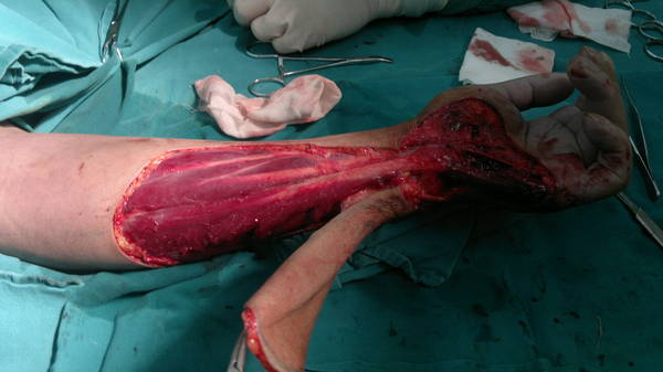 20120309077.jpg