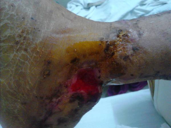 IMG_20120407_085257.jpg