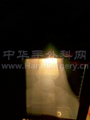 X光2.jpg