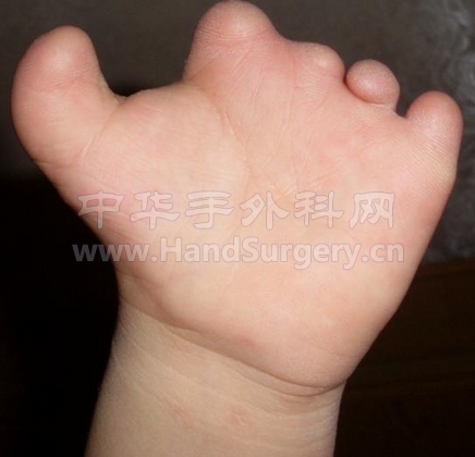 左手心